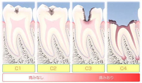 早期治療のすすめ